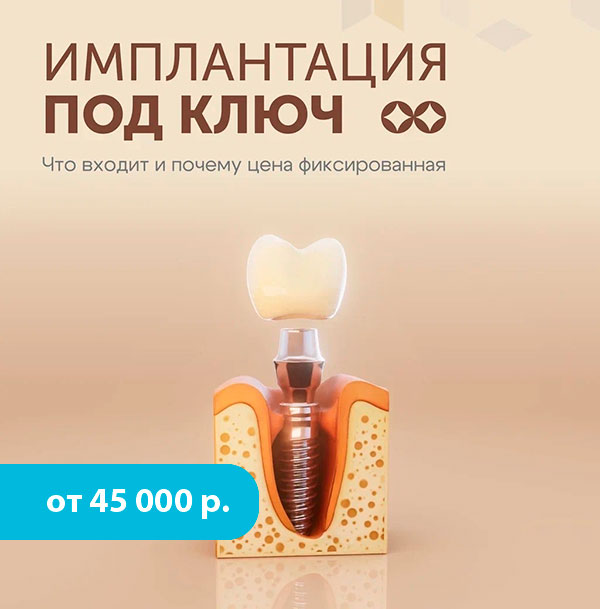 Имплантация под ключ Красноярск 