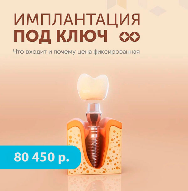 Имплантация зубов под ключ стоматология Медика Красноярск